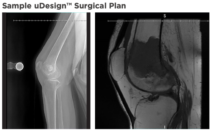 surgical-left