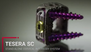 Tesera SC Stand-Alone Cervical Interbody System Surgical Technique 