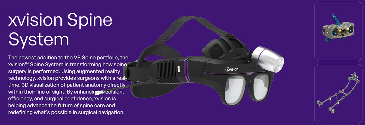 xvision spine system