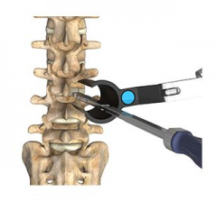 Spinal Access and Decompression Products