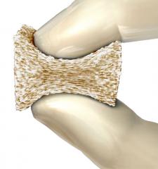 VESUVIUS Demineralized Sponge Osteobiologic System
