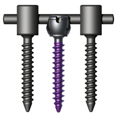 MESA® Degenerative Spinal System