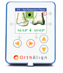 KneeAlign® Technology