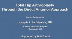Taperfill™ Hip System Product